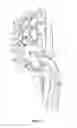 Fig. 03 - METHOD & APPARATUS FOR ARTHROSCOPIC BICEPS TENODESIS