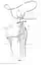 Fig. 04 - METHOD & APPARATUS FOR ARTHROSCOPIC BICEPS TENODESIS