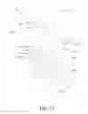 Fig. 20 - Lumbar implant