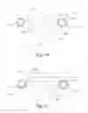 Fig. 28 - Lumbar implant