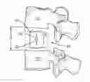 Fig. 01 - Vertebral implant containment device and methods of use