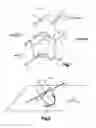 Fig. 02 - ARTICULATING DISC IMPLANT