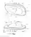 Fig. 04 - ARTICULATING DISC IMPLANT