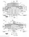 Fig. 05 - ARTICULATING DISC IMPLANT