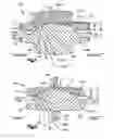 Fig. 06 - ARTICULATING DISC IMPLANT