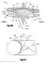 Fig. 11 - ARTICULATING DISC IMPLANT