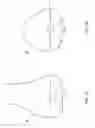Fig. 02 - Patient-adapted and improved articular implants, designs and related guide tools