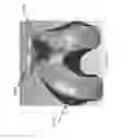 Fig. 167 - Patient-adapted and improved articular implants, designs and related guide tools