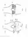 Fig. 22 - Patient-adapted and improved articular implants, designs and related guide tools