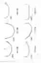 Fig. 43 - Patient-adapted and improved articular implants, designs and related guide tools