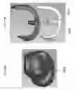 Fig. 45 - Patient-adapted and improved articular implants, designs and related guide tools