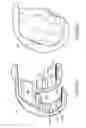 Fig. 63 - Patient-adapted and improved articular implants, designs and related guide tools