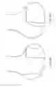 Fig. 72 - Patient-adapted and improved articular implants, designs and related guide tools