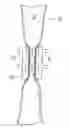 Fig. 01 - Apparatus for controlling flow in a bodily organ