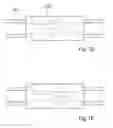 Fig. 03 - Apparatus for controlling flow in a bodily organ