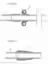 Fig. 113 - Apparatus for controlling flow in a bodily organ