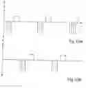 Fig. 12 - Apparatus for controlling flow in a bodily organ