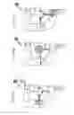 Fig. 129 - Apparatus for controlling flow in a bodily organ