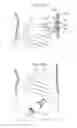 Fig. 150 - Apparatus for controlling flow in a bodily organ