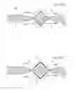 Fig. 153 - Apparatus for controlling flow in a bodily organ