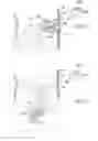 Fig. 159 - Apparatus for controlling flow in a bodily organ