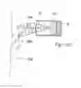 Fig. 16 - Apparatus for controlling flow in a bodily organ