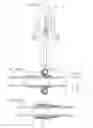 Fig. 172 - Apparatus for controlling flow in a bodily organ