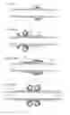 Fig. 174 - Apparatus for controlling flow in a bodily organ