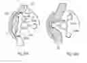 Fig. 33 - Apparatus for controlling flow in a bodily organ