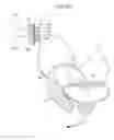 Fig. 40 - Apparatus for controlling flow in a bodily organ