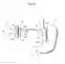 Fig. 43 - Apparatus for controlling flow in a bodily organ