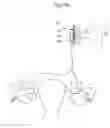 Fig. 46 - Apparatus for controlling flow in a bodily organ