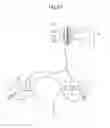 Fig. 47 - Apparatus for controlling flow in a bodily organ