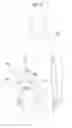 Fig. 53 - Apparatus for controlling flow in a bodily organ