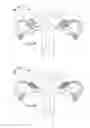 Fig. 66 - Apparatus for controlling flow in a bodily organ
