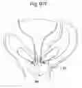 Fig. 71 - Apparatus for controlling flow in a bodily organ