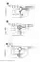 Fig. 90 - Apparatus for controlling flow in a bodily organ