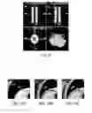 Fig. 08 - Three-dimensional visualization and analysis method and system for non-destructive examination of a rotor bore using ultrasound