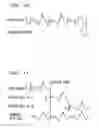 Fig. 09 - Method and apparatus for performing packet loss or frame erasure concealment