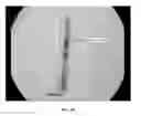 Fig. 05 - METHOD FOR PRODUCING ROD-SHAPED AND BRANCHED METALLIC NANO-STRUCTURES BY POLYOL COMPOUNDS