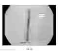 Fig. 09 - METHOD FOR PRODUCING ROD-SHAPED AND BRANCHED METALLIC NANO-STRUCTURES BY POLYOL COMPOUNDS