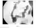 Fig. 20 - METHOD FOR PRODUCING ROD-SHAPED AND BRANCHED METALLIC NANO-STRUCTURES BY POLYOL COMPOUNDS