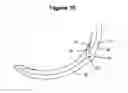 Fig. 09 - IMPROVED FILM-COOLED INTERNAL COMBUSTION ENGINE