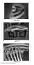 Fig. 40 - Powered roller conveyor systems