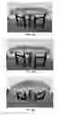 Fig. 41 - Powered roller conveyor systems