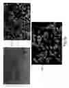 Fig. 10 - Granules, tablets and granulation