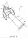 Fig. 04 - REMOVABLE NOZZLE