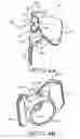 Fig. 05 - REMOVABLE NOZZLE