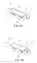 Fig. 04 - Front-depression stapling device