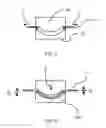 Fig. 04 - Process for manufacturing an ophthalmic lens